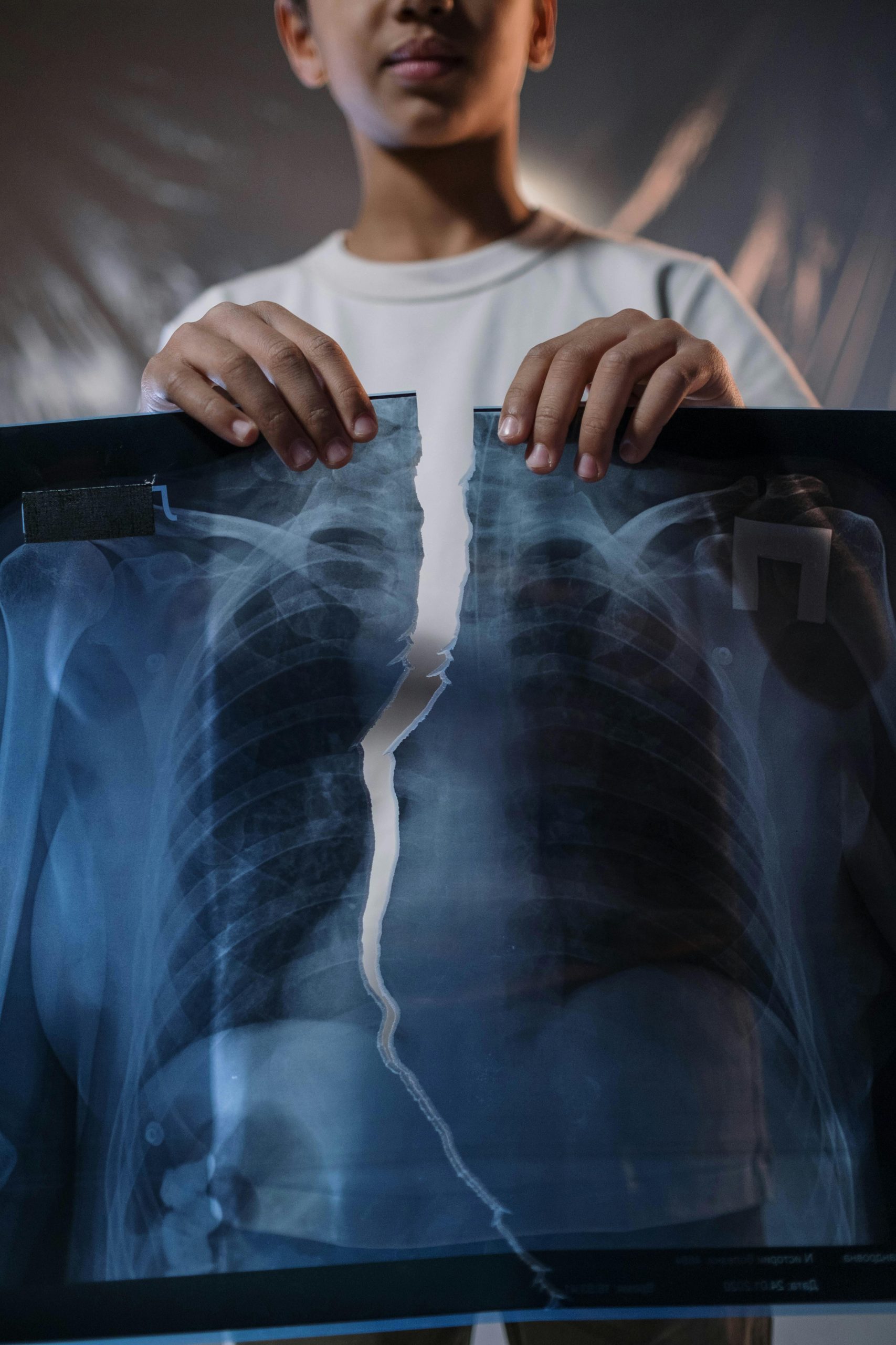 A child holds a torn X-ray image, highlighting healthcare themes.